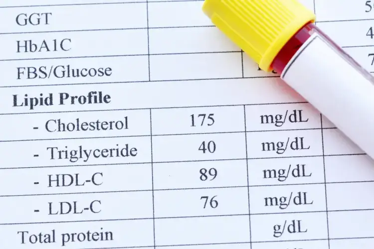 Dieta keto a cholesterol - Jak czytać wyniki i uniknąć wzrostu LDL?